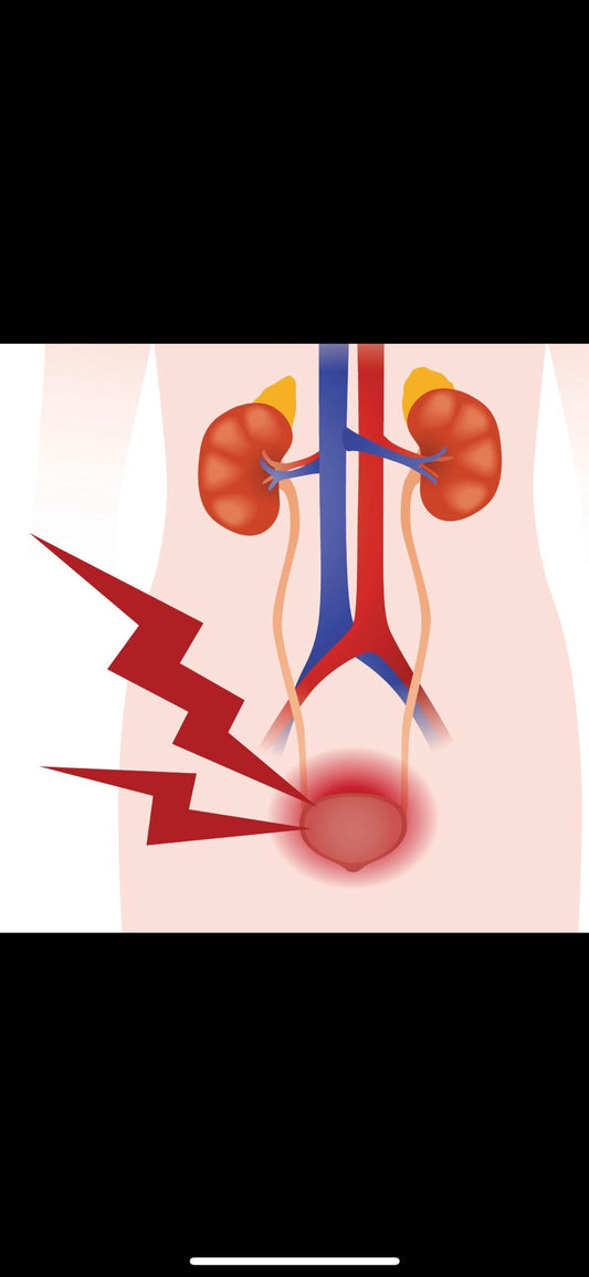 Usturime la urinare fara infectie - ilustratie sistem urinar si vezica